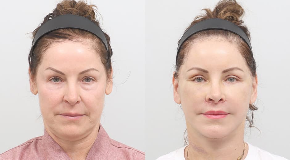 AB Plastic Surgery
