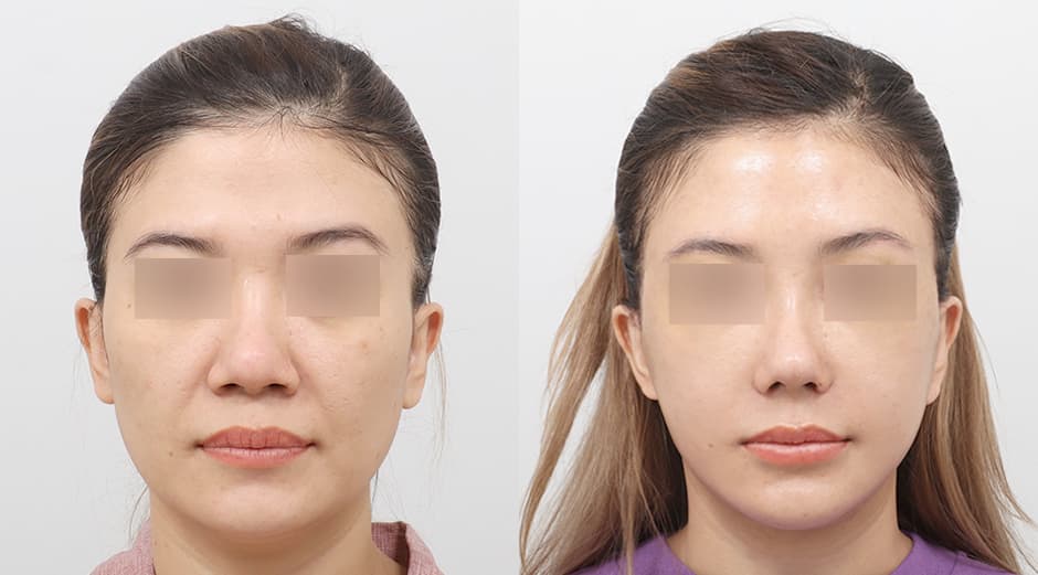 AB Plastic Surgery