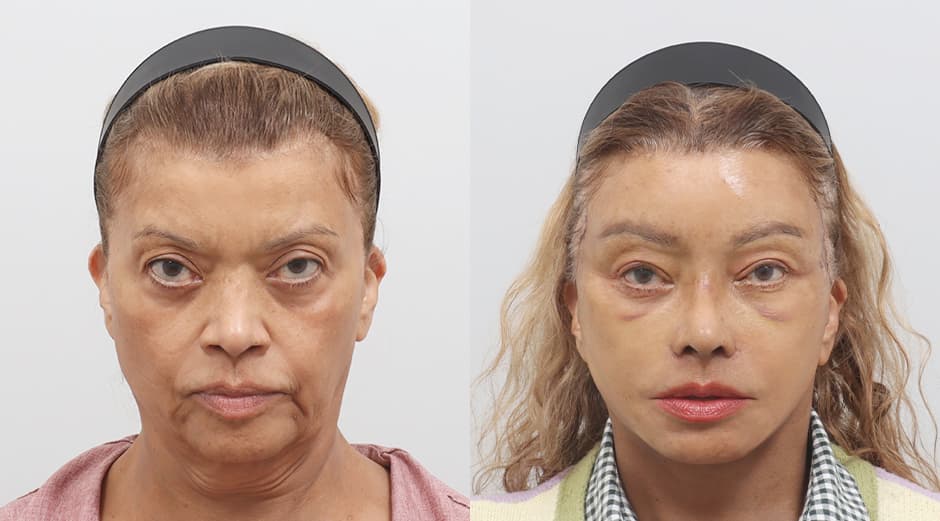 AB Plastic Surgery