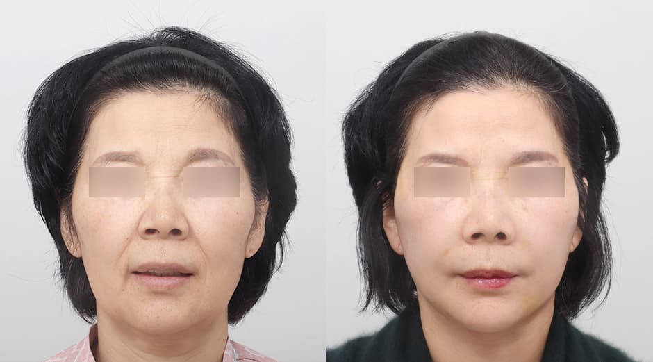 AB Plastic Surgery