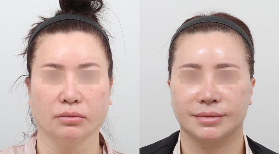 AB Plastic Surgery