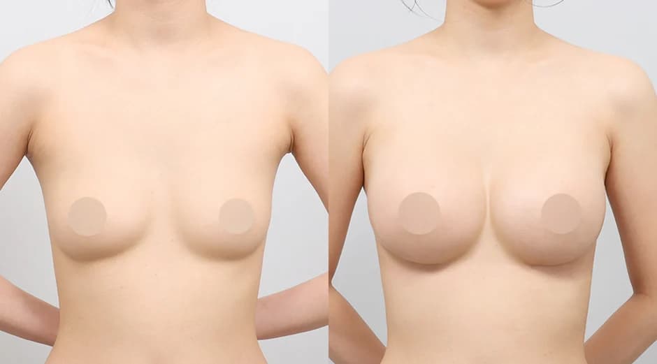 AB Plastic Surgery