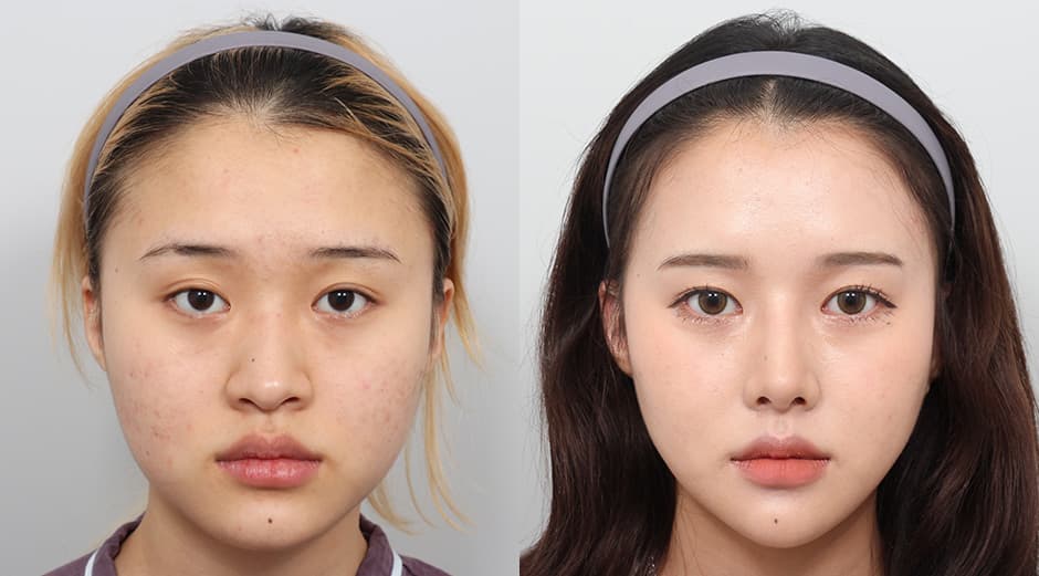 AB Plastic Surgery