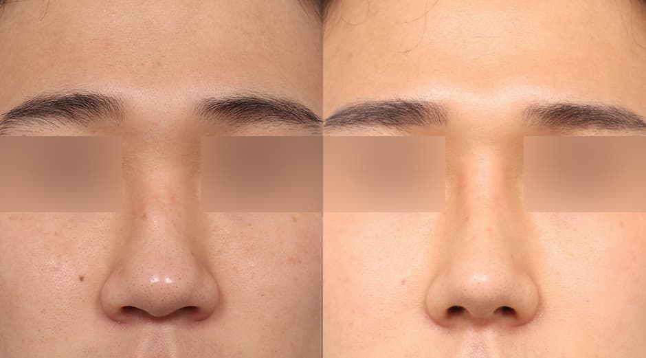 AB Plastic Surgery