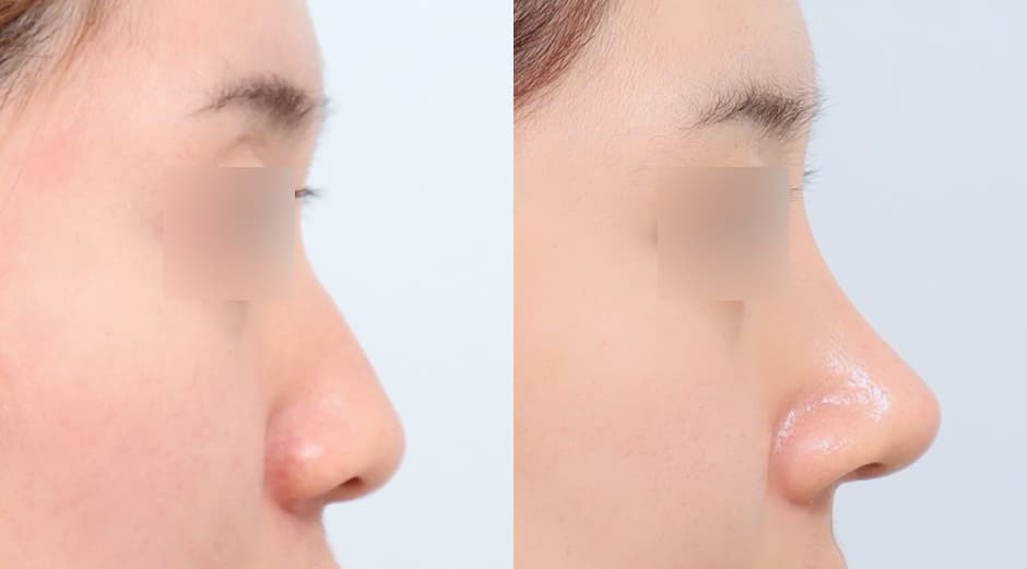 AB Plastic Surgery