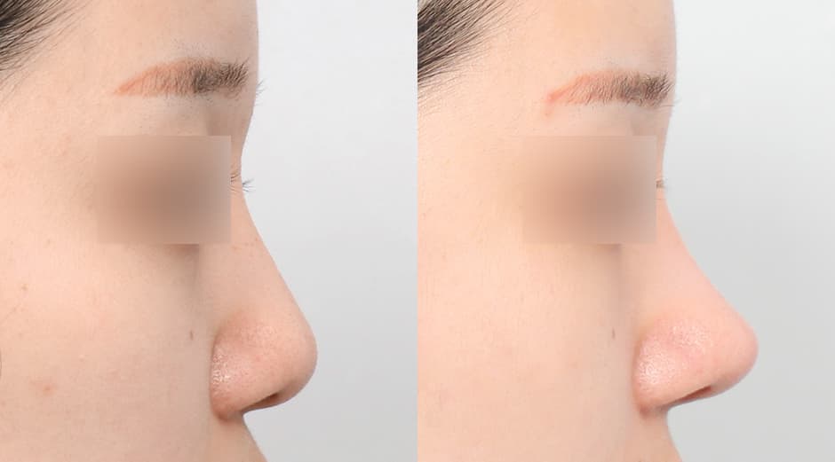 AB Plastic Surgery