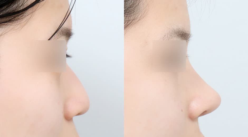 AB Plastic Surgery