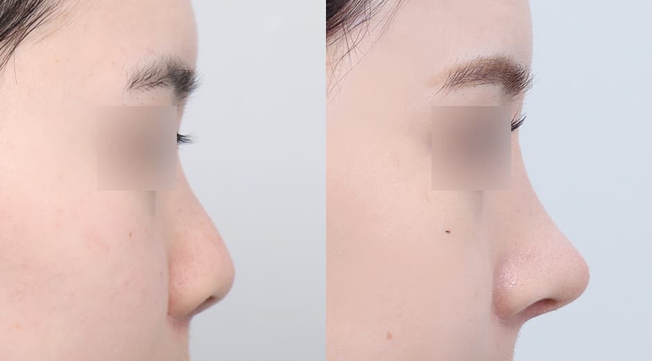 AB Plastic Surgery