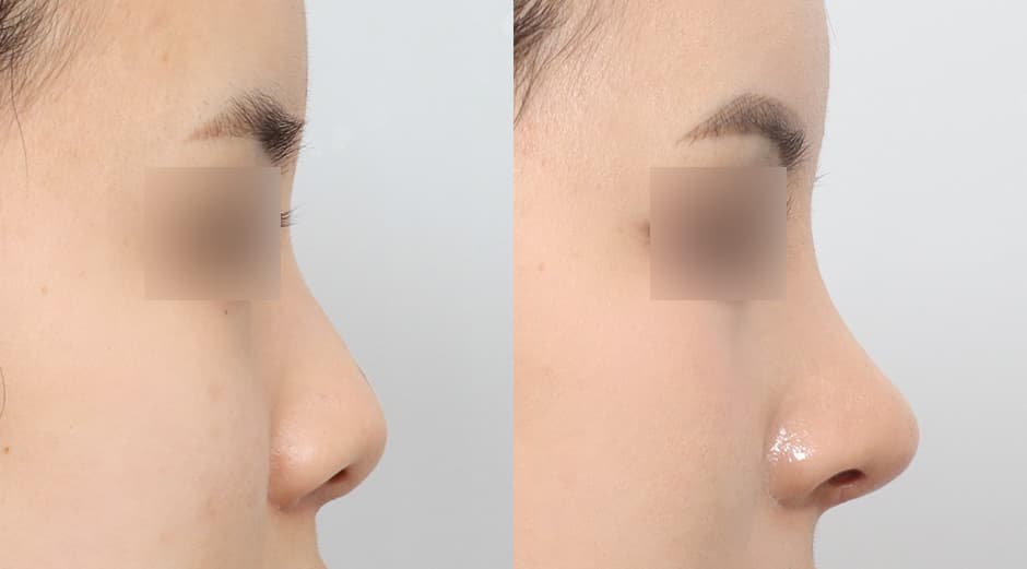 AB Plastic Surgery