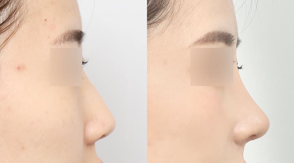 AB Plastic Surgery