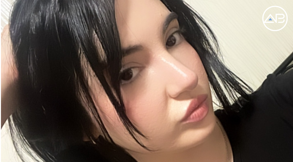 My Successful Nose Job Journey! 
