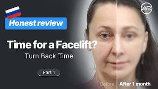 Part1. Deep plane facelift, Neck lift surgery Transformation✨Real Vlog at AB Plastic Surgery Korea