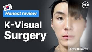 Facial Contouring & Ptosis Correction ✨ Real Consultation Vlog | AB Plastic Surgery Korea