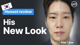 Before Rhinoplasty & Eye Surgery Real Consultation Vlog | AB Plastic Surgery