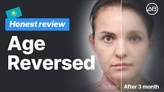 Real Face Lift Korea Patient Journey: Before & After Interview at AB Plastic Surgery korea