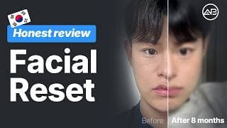 You Won’t Believe This Transformation👀 | Korea Plastic Surgery
