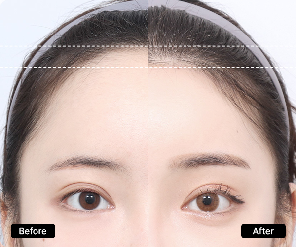 AB Plastic Surgery Ideal face proportions visual