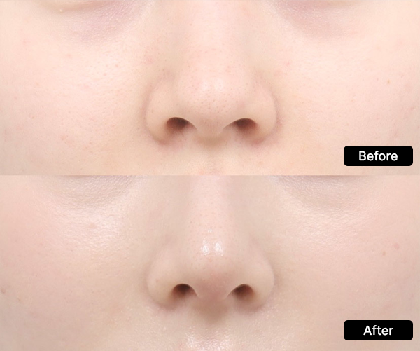 AB Plastic Surgery Precisely with a slim design visual