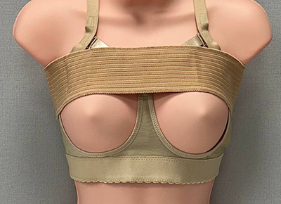 Customized Supportive Bras surgery illustration