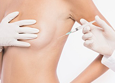 PDRN Regeneration Injection surgery illustration