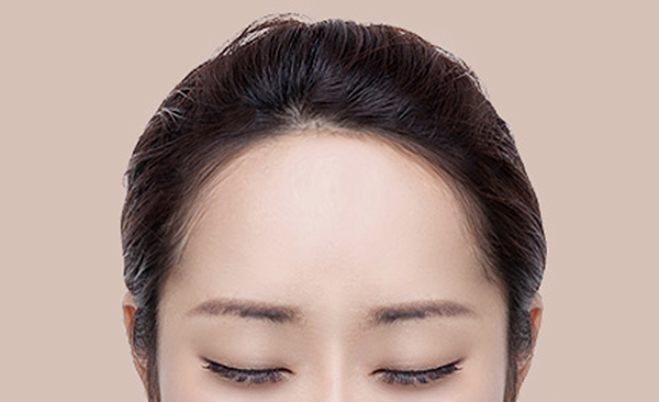 STEP 4. surgery illustration