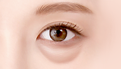 01. Before surgery surgery illustration