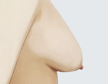 Level 2