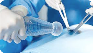 AB surgery