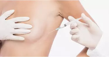 Scar Regeneration Injection surgery illustration