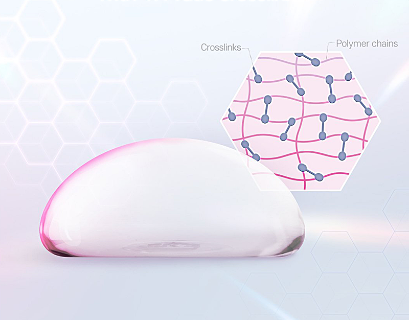 Mentor Boost is designed with a 1:1 ratio of internal gel, offering a firmer and more resilient feel compared to the existing Mentor Extra. surgery illustration