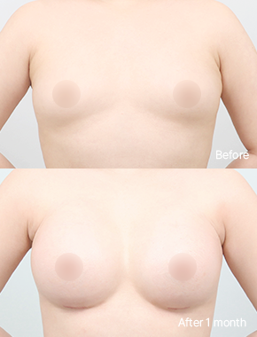 before-after