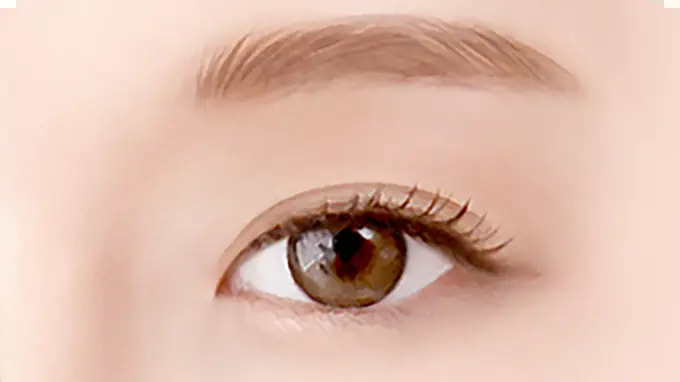 Step 1. Before Surgery surgery illustration