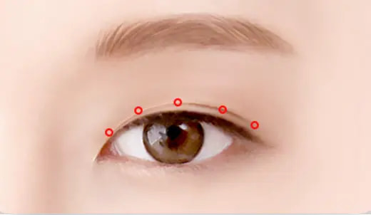 STEP 2. Customized design surgery illustration
