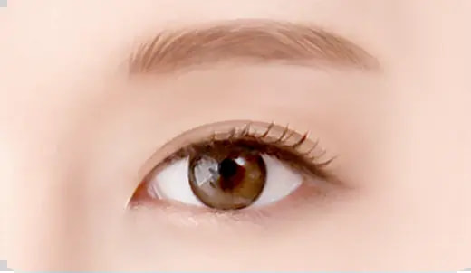 STEP 5. After surgery surgery illustration