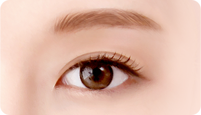 Cases where eye correction is harmonious with double eyelids surgery illustration
