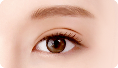 In case of deep eyelids surgery illustration