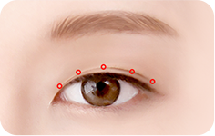 02. STEP surgery illustration