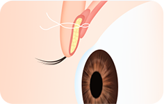 Surgery illustration