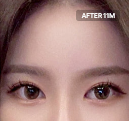 Before and After