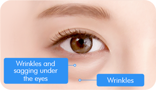 Step 1. Before Surgery surgery illustration