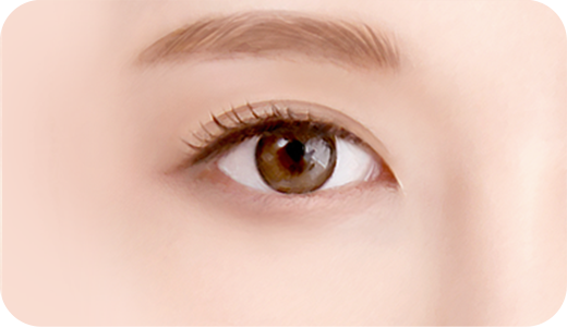 Step 5. After surgery surgery illustration