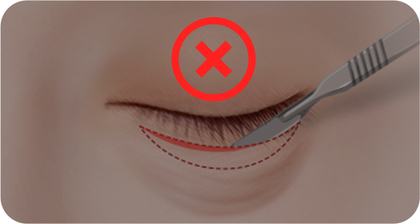 Surgery illustration