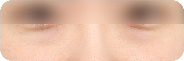 Before and After