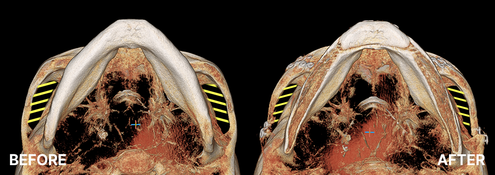 Surgery illustration