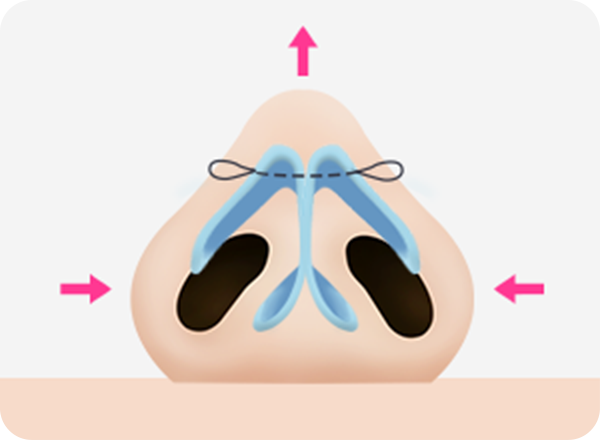 Surgery illustration