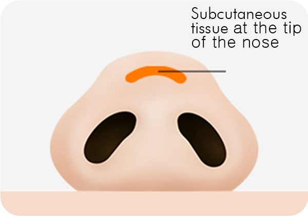 Surgery illustration