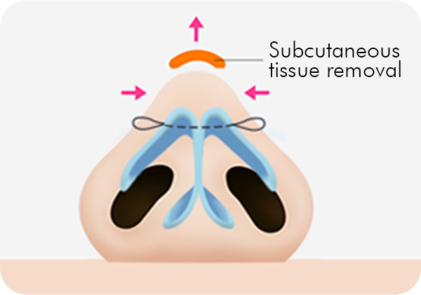 Surgery illustration