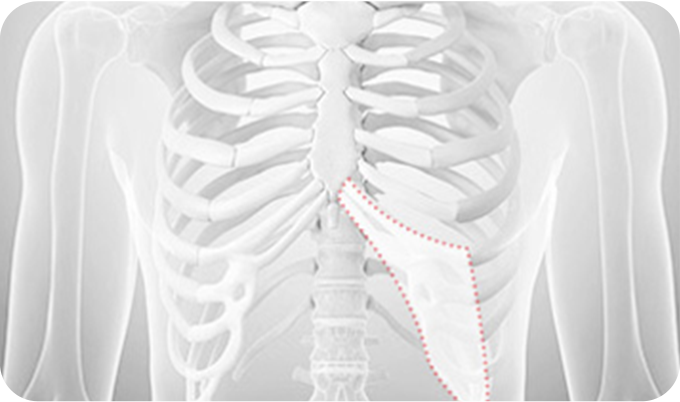 02. Costal(Rib) Cartilage surgery illustration