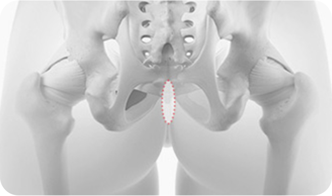 03. Autologous Dermis surgery illustration
