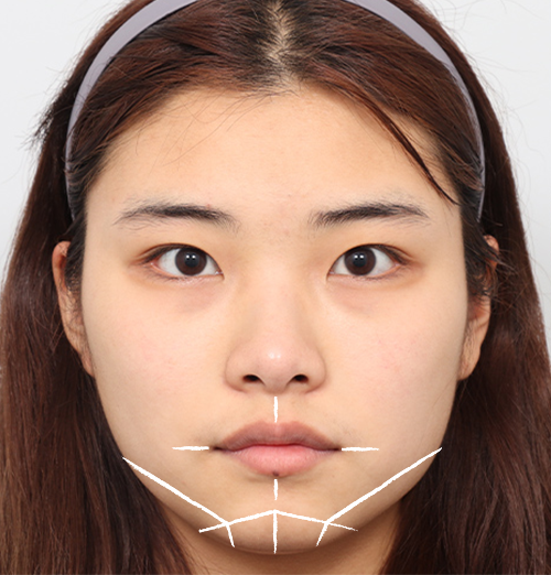 Customized design surgery illustration